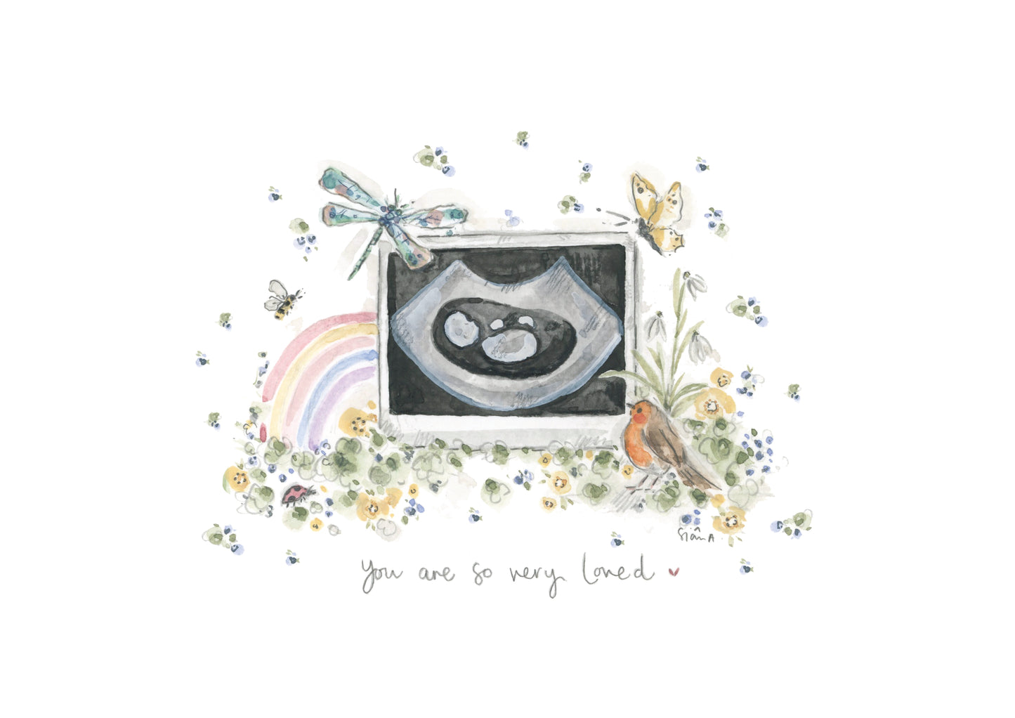 So Very Loved Baby Scan/Sonogram Print"  A sentimental keepsake art print for your little one and a precious way to remember and hold them close, watercolour fine art print by Siân Alexia Paine.